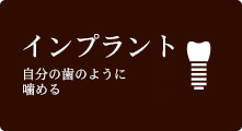 自分の歯のように噛める インプラント