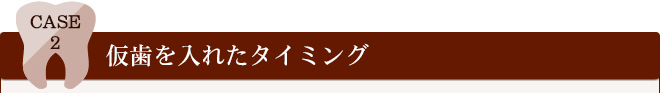 CASE2	仮歯を入れたタイミング