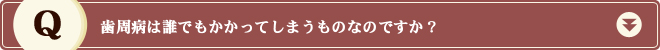 歯周病は誰でもかかってしまうものなのですか？